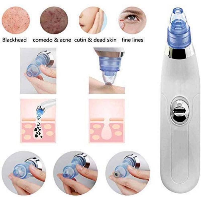 Buy Derma Suction Facial Pore Cleanser in Pakistan